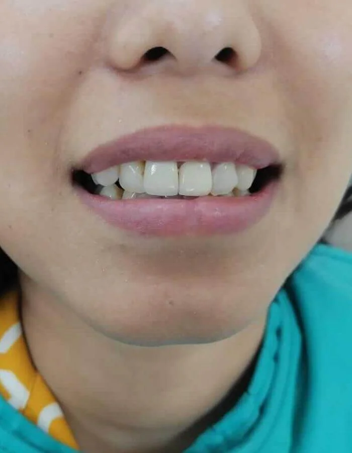heal&smile