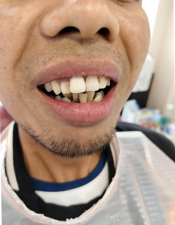 heal&smile