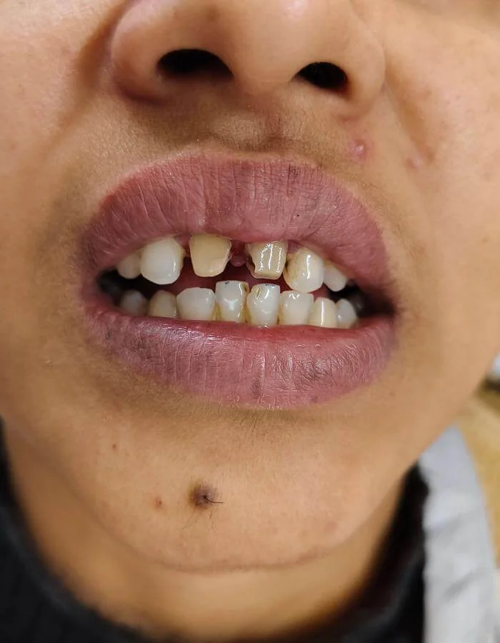 heal&smile
